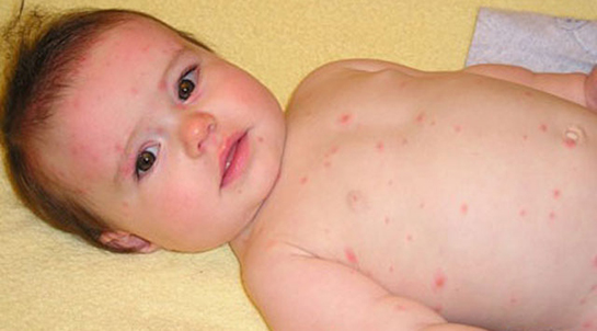 Su Çiçeği Kuluçka Süresi