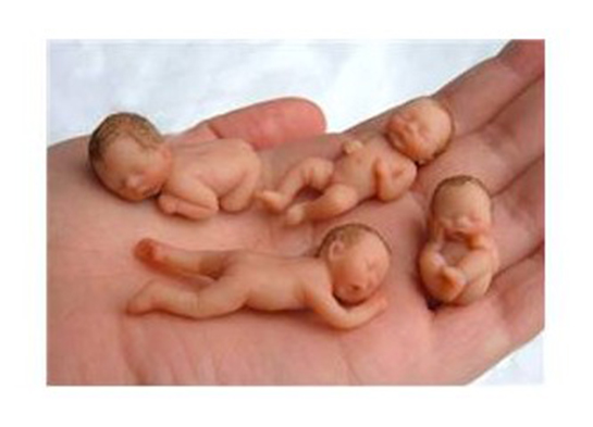 Yeni Doğan Bebeklerde Su Çiçeği Belirtileri ve Tedavisi